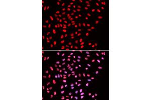 Immunofluorescence analysis of U2OS cells using B/B/SM antibody . (SMARCE1 anticorps  (AA 1-411))