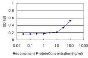 anti-Superoxide Dismutase 3, Extracellular (SOD3) (AA 26-125) antibody