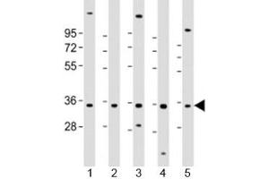 Western blot testing of human 1) HL-60, 2) K562, 3) MCF-7, 4) MOLT-4 and 5) SH-SY5Y cell lysate with PIGC antibody at 1:2000. (PIGC anticorps  (AA 81-112))