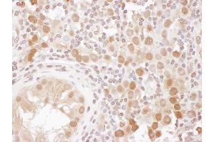 Immunohistochemistry (IHC) image for anti-CSE1 Chromosome Segregation 1-Like (CSE1L) (AA 1-50) antibody (ABIN7453909) (Exportin 2 anticorps  (AA 1-50))