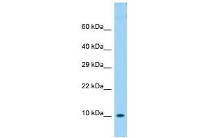Host: Rabbit Target Name: COX6B1 Sample Type: OVCAR-3 Whole Cell lysates Antibody Dilution: 1. (COX6B1 anticorps  (N-Term))