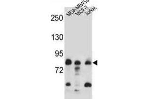Western Blotting (WB) image for anti-AFG3-Like Protein 2 (AFG3L2) antibody (ABIN2997215) (AFG3L2 anticorps)