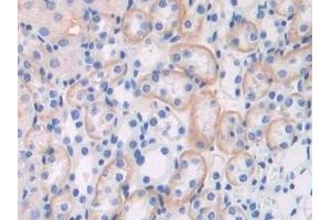 Detection of BCAN in Mouse Kidney Tissue using Polyclonal Antibody to Brevican (BCAN)