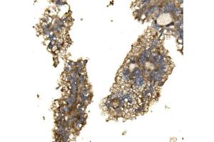 IHC analysis of ARG2 using anti-ARG2 antibody (ABIN7599304).