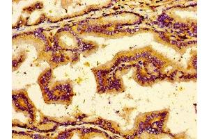 Immunohistochemistry of paraffin-embedded human prostate tissue using ABIN7161453 at dilution of 1:100