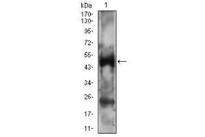 Western blot analysis using PTPN1 mouse mAb against A431 cell lysate. (PTPN1 anticorps  (AA 40-246))