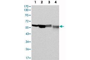 Western blot analysis using G6PD monoclonal antibody, clone 5E12  against HeLa (1) , MCF-7 (2) , Jurkat (3) and K-562 (4) cell lysate.