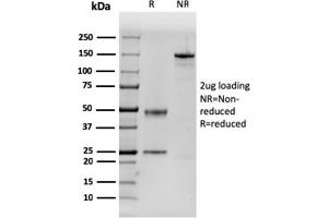 SDS-PAGE Analysis Purified Dystrophin Monospecific Mouse Monoclonal Antibody (DMD/3243). (Dystrophin anticorps  (AA 114-263))