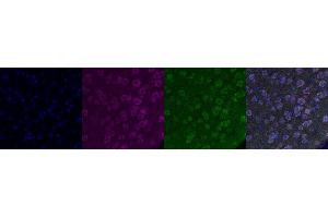 Immunohistochemistry (IHC) image for anti-Transient Receptor Potential Cation Channel, Subfamily C, Member 6 (TRPC6) antibody (ABIN7456114)