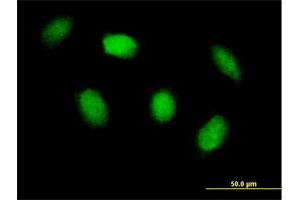 Immunofluorescence of purified MaxPab antibody to HIPK4 on HeLa cell.