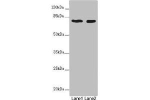 Western blot All lanes: UVRAG antibody at 2 μg/mL Lane 1: SH-SY5Y whole cell lysate Lane 2: 293T whole cell lysate Secondary Goat polyclonal to rabbit IgG at 1/10000 dilution Predicted band size: 79, 36 kDa Observed band size: 79 kDa (UVRAG anticorps  (AA 375-425))