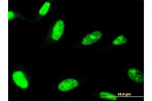 Immunofluorescence of monoclonal antibody to ZNF81 on HeLa cell. (ZNF81 anticorps  (AA 1-122))