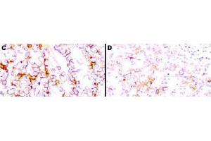 Immunohistochemistry (IHC) image for anti-Mesothelin (MSLN) (Extracellular Domain) antibody (ABIN400817) (Mesothelin anticorps  (Extracellular Domain))