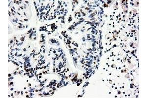 Immunohistochemistry (IHC) image for anti-5'-Nucleotidase Domain Containing 1 (NT5DC1) antibody (ABIN1499838)