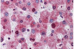 Human Liver: Formalin-Fixed, Paraffin-Embedded (FFPE)