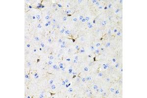 Immunohistochemistry of paraffin-embedded mouse brain using ACVR2A antibody (ABIN5971030) at dilution of 1/100 (40x lens). (ACVR2A anticorps)