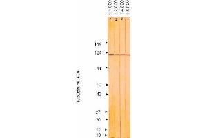 Western Blotting (WB) image for anti-Herpes Simplex Virus Type 2 ICP8 (HSV2 ICP8) antibody (ABIN265566) (HSV2 ICP8 anticorps)