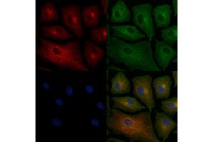 ABIN6258567 and ABIN6276236 staining  cells by IF/ICC. (VN1R2 anticorps  (Internal Region))