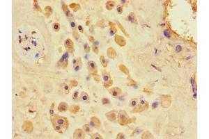 Immunohistochemistry of paraffin-embedded human placenta tissue using ABIN7154826 at dilution of 1:100 (TSC1 anticorps  (AA 101-344))