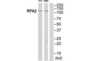 Western blot analysis of extracts from Jurkat/NIH-3T3 cells, using POLR1B antibody. (POLR1B anticorps  (C-Term))
