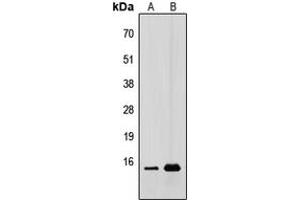 Western blot analysis of CDC42EP5 expression in HEK293T (A), A431 (B) whole cell lysates. (CDC42EP5 anticorps  (N-Term))