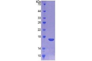 SDS-PAGE of Protein Standard from the Kit (Highly purified E. (Cathepsin D Kit ELISA)