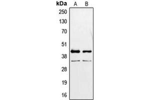 Western blot analysis of PAX2 expression in MCF7 (A), K562 (B) whole cell lysates. (PAX2A anticorps  (Center))