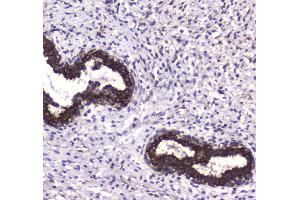 IHC analysis of MAP1LC3A using anti-MAP1LC3A antibody . (MAP1LC3A anticorps  (AA 1-120))