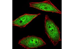 Fluorescent image of U251 cells stained with hNEK2-C410 .