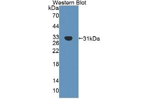Detection of Recombinant Agrin, Human using Polyclonal Antibody to Agrin (AGRN) (AGRN anticorps  (AA 1329-1548))