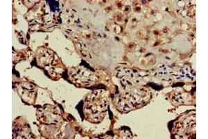Immunohistochemistry of paraffin-embedded human placenta tissue using ABIN7153311 at dilution of 1:100