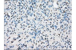 Immunohistochemical staining of paraffin-embedded pancreas tissue using anti-LTA4H mouse monoclonal antibody. (LTA4H anticorps)