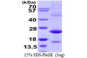 SDS-PAGE (SDS) image for Activating Transcription Factor 3 (ATF3) (AA 1-181) protein (ABIN667497) (ATF3 Protein (AA 1-181))
