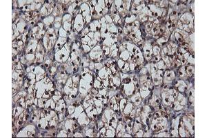 Image no. 1 for anti-Musashi Homolog 1 (Drosophila) (MSI1) antibody (ABIN1499573)