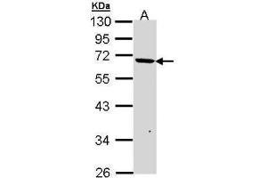 WB Image Sample (30 ug of whole cell lysate) A: A431 , 10% SDS PAGE antibody diluted at 1:1000