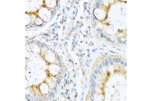 Immunohistochemistry of paraffin-embedded human colon using NTF4 antibody at dilution of 1:100 (40x lens). (Neurotrophin 4 anticorps)