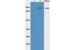 Lane 1: mouse kidney lysates Lane 2: mouse liver lysates probed with Anti NCX1/SLC8A1 Polyclonal Antibody, Unconjugated (ABIN731198) at 1:200 in 4 °C. (SLC8A1 anticorps  (AA 801-900))