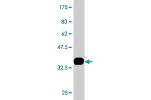 Western Blot detection against Immunogen (35. (HNF1B anticorps  (AA 29-118))