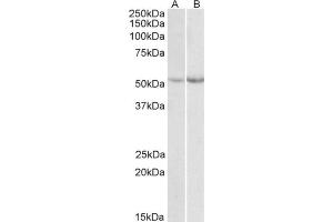 AP21507PU-N Phe Hydoxylase antibody staining of Mouse (A)  and Rat (B) Liver lysate at 0. (Phenylalanine Hydroxylase anticorps  (Internal Region))