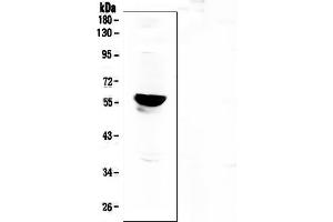 Western blot analysis of Aromatase using anti-Aromatase antibody (ABIN6719449).