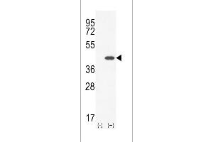 Western blot analysis of CLEC11A (arrow) using rabbit polyclonal CLEC11A Antibody (Center) (ABIN655039 and ABIN2844670). (CLEC11A anticorps  (AA 145-174))