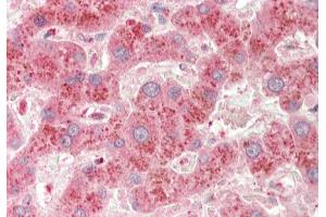 Rabbit Anti-A1BG antibody Catalog Number: ARP33811 Formalin Fixed Paraffin Embedded Tissue: Human Liver Primary antibody Concentration: 1:100 Secondary Antibody: Donkey anti-Rabbit-Cy3 Secondary Antibody Concentration: 1:200 Magnification: 20x Exposure Time: 0.