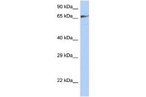 WB Suggested Anti-ZNF676 Antibody Titration:  0. (ZNF676 anticorps  (Middle Region))