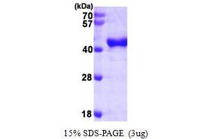 SDS-PAGE (SDS) image for 2',5'-Oligoadenylate Synthetase 1, 40/46kDa (OAS1) (AA 1-364) protein (His tag) (ABIN666789) (OAS1 Protein (AA 1-364) (His tag))