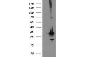 Image no. 4 for anti-Phenylethanolamine N-Methyltransferase (PNMT) antibody (ABIN1500307) (PNMT anticorps)