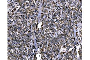 IHC analysis of KPNA2 using anti-KPNA2 antibody (ABIN7601936).