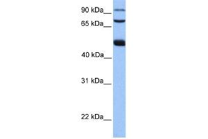 WB Suggested Anti-WDR49 Antibody Titration: 0. (WDR49 anticorps  (C-Term))