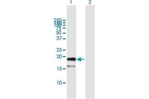 Western Blot analysis of TDGF1 expression in transfected 293T cell line by TDGF1 MaxPab polyclonal antibody. (TDGF1 anticorps  (AA 1-188))
