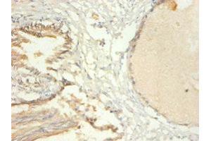 Immunohistochemistry of paraffin-embedded human prostate tissue using ABIN7172712 at dilution of 1:100 (KAP1 anticorps  (AA 22-291))
