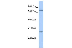 WB Suggested Anti-RCHY1 Antibody Titration:  0. (RCHY1 anticorps  (N-Term))